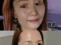 如何提升以脸上苹果机的使用体验（探索实用技巧，让你的苹果机更出众）