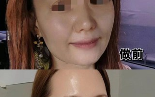 如何提升以脸上苹果机的使用体验（探索实用技巧，让你的苹果机更出众）