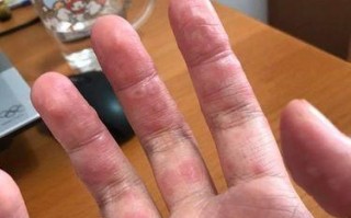 中病毒的威胁与应对（揭开中病毒的谜团，从开始探索）