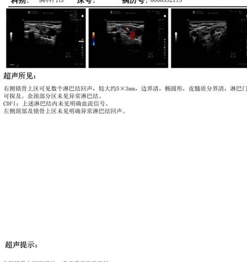 分区表医生使用教程（掌握分区表技术，助力医生高效处理海量数据）-第3张图片-数码深度